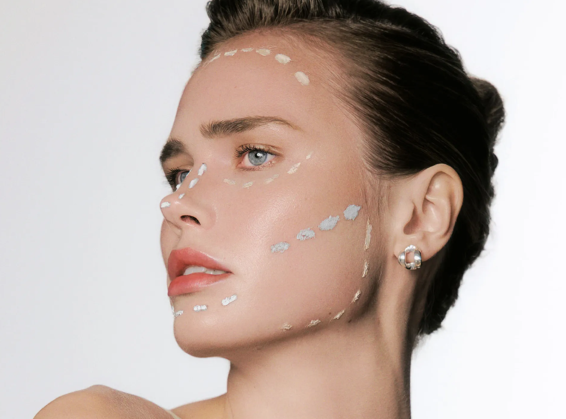 Deep Plane Facelift (Derin Plan Yüz Germe)