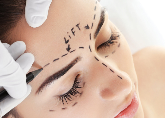 Kaş Kaldırma (Brow Lift)