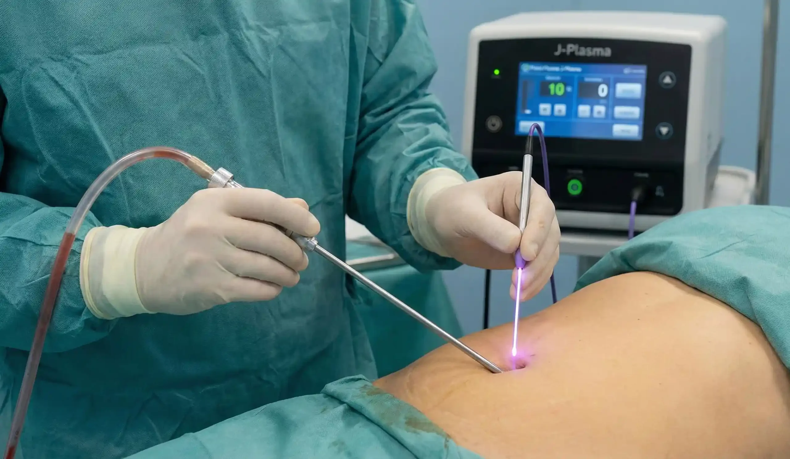 J-Plasma