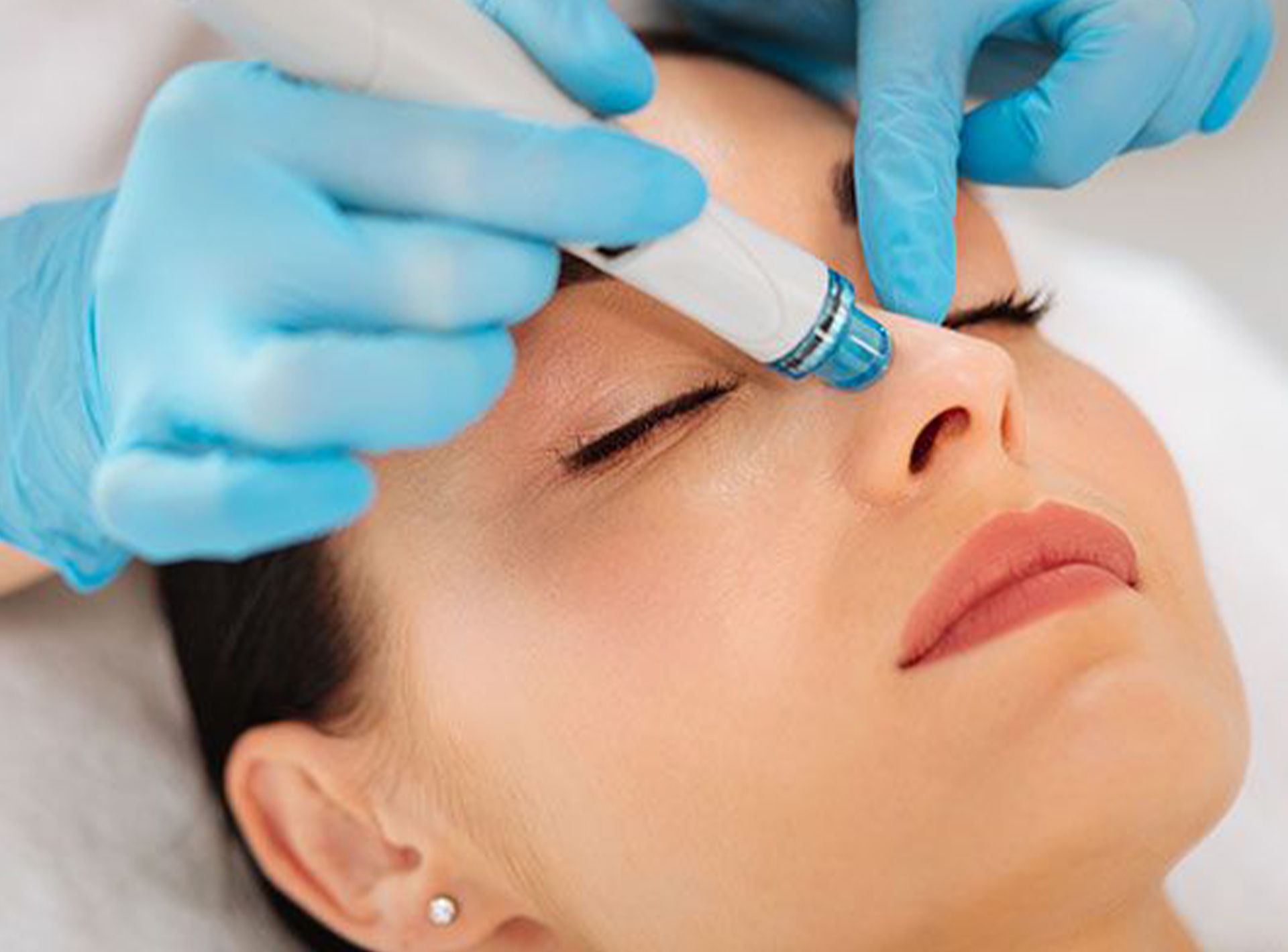 Hydrafacial