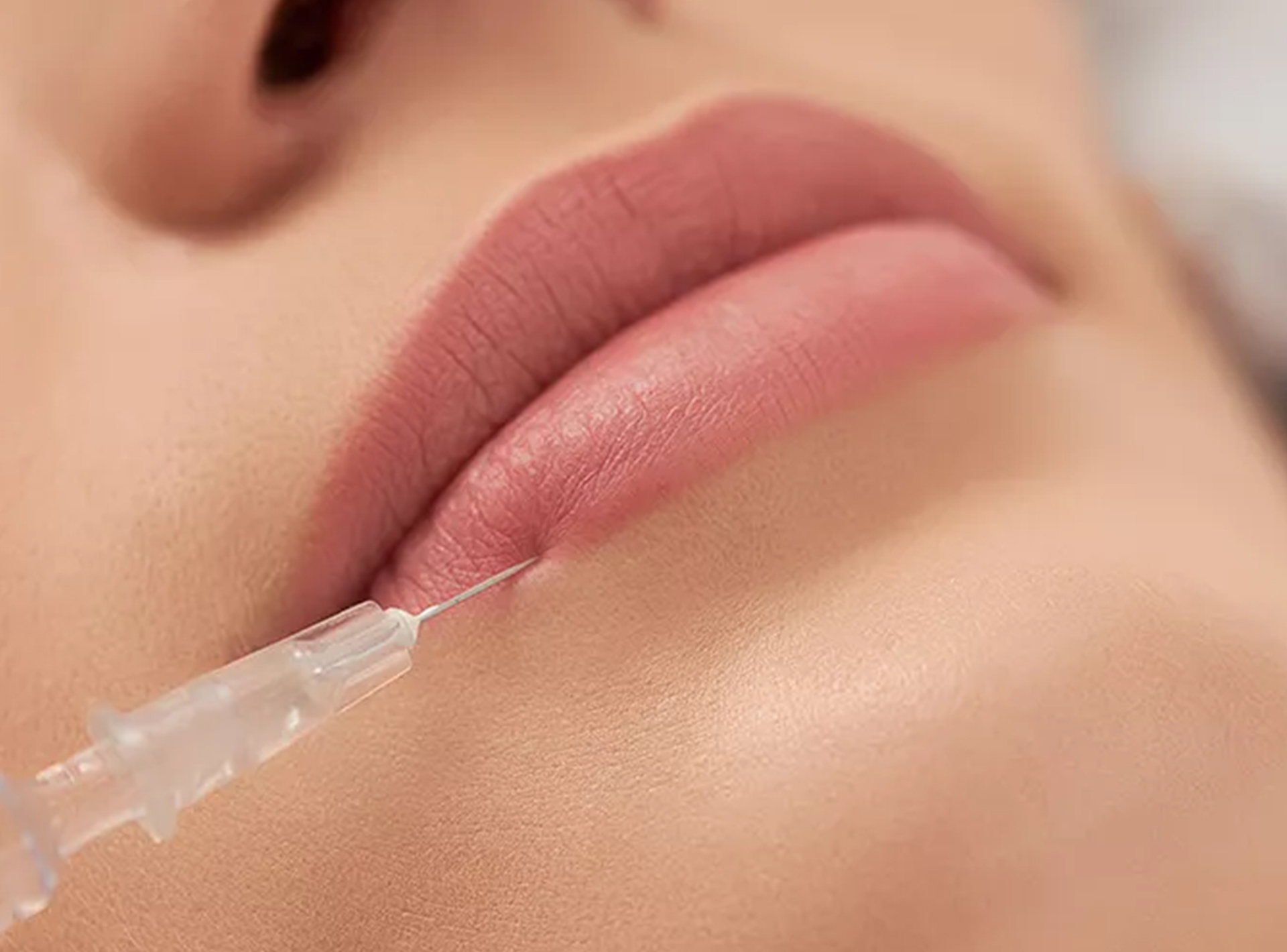 Liplift
